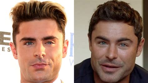 zac efron third nipple|Zac Efron’s Face Before & After Surgery—Here’s What Really Happened .